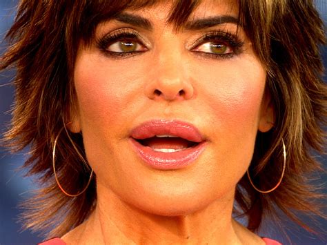 lisa rinna new lips